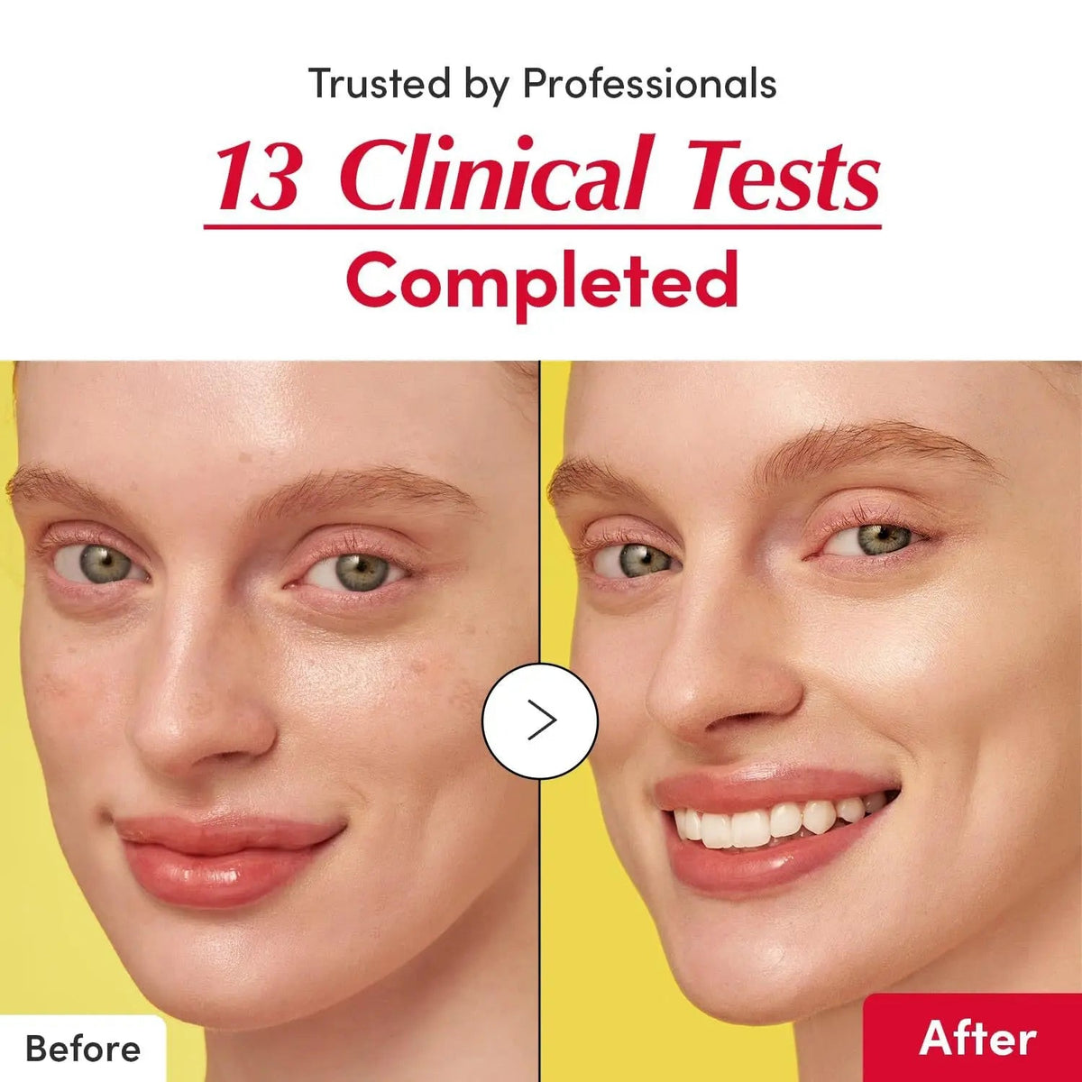 Vitamin whitening serum, niacinamide vitamin C serum, bakuchiol plumping serum, shrink pores, reduce wrinkles, and lift skin - FloraDigest Co.